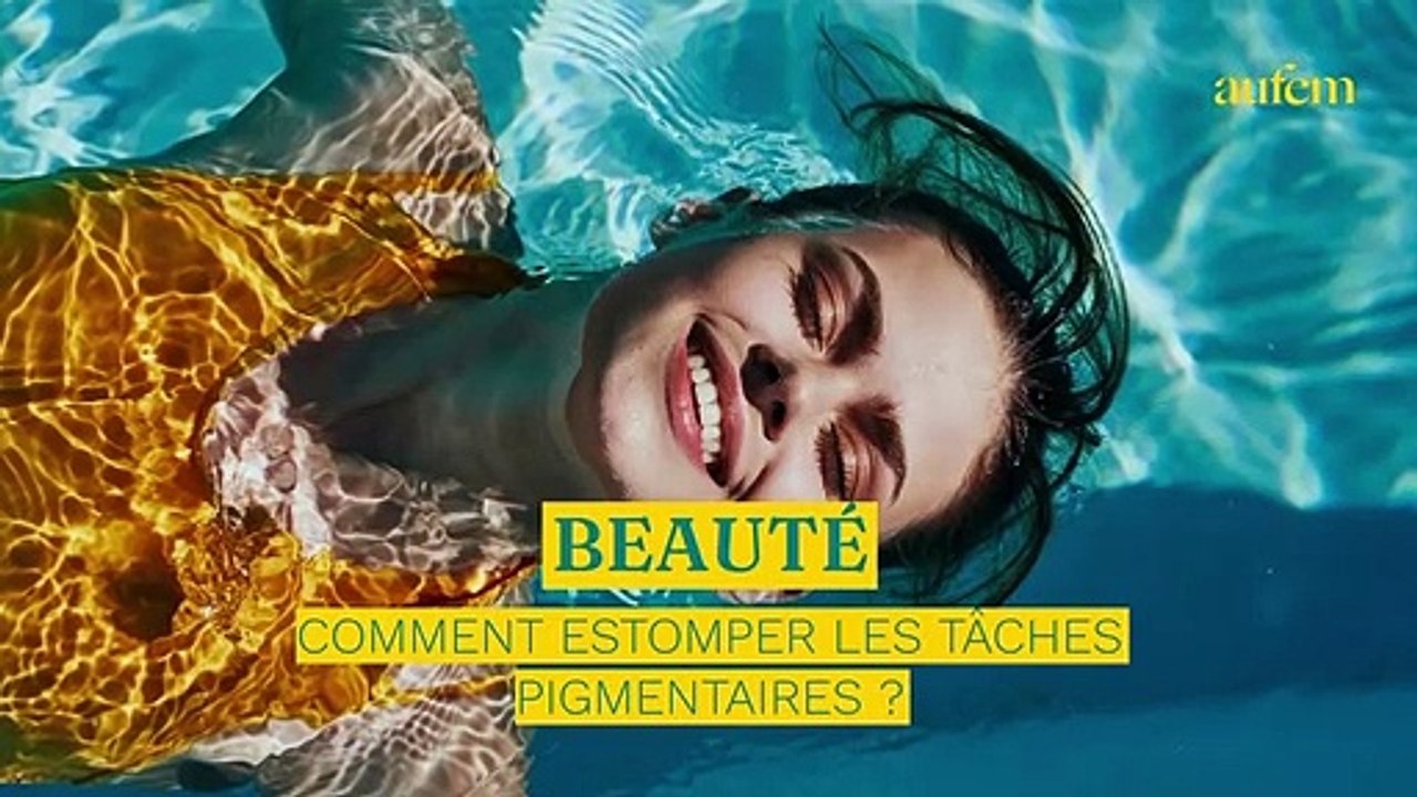 Taches pigmentaires : l'avis d'un dermatologue sur les traitements au laser pour les estomper