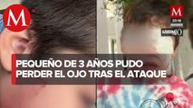 Presuntos Yaquis agreden a familia y niño de 3 años casi pierde un ojo en Sonora