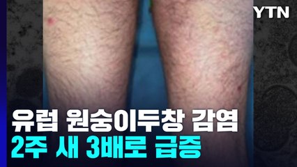 유럽 원숭이두창 감염 2주새 3배로...WHO "긴급 조처 필요" / YTN