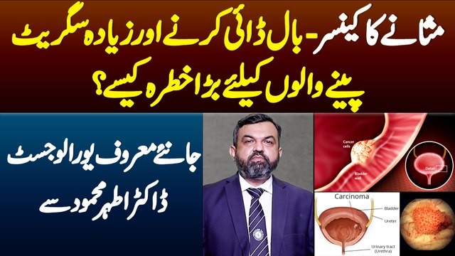 Prostate Cancer-Baal Dye Karne,Ziada Cigarette Pene Walo K Liye Bara Khatra Kaise?Janiye Dr Athar Se
