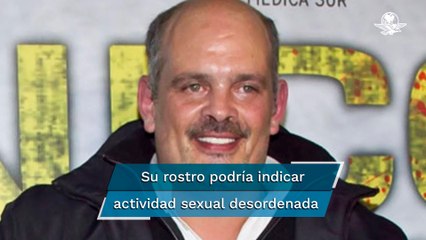 ¿Qué esconde el rostro de Coco Levy? El productor acusado de violentar a actrices