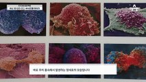 면역력 담당 세포가 있다? 우리 몸 선천면역세포 대표 주자 'NK 세포'!