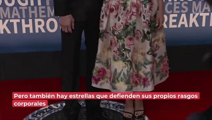 Famosos que han hablado abiertamente sobre sus "defectos" físicos