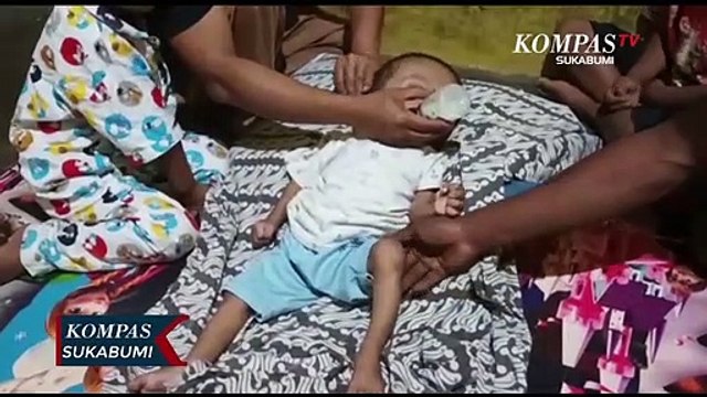 Balita Di Sukabumi Idap Penyakit Hydrocephalus