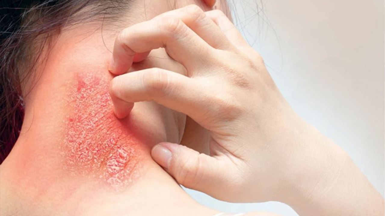 दाद क्यों होता है | RingWorm Kyu Hote Hai, खतरनाक है वजह | Boldsky *Health
