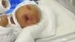 Kalıtımsal hastalıkla doğan bebek hastaneyi alarma geçirdi, yüzünü gören doktorlar dehşete kapıldı