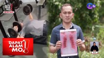 Lalaking pumutok ang baga, pagbubuhat sa gym ang tinuturong sanhi? | Dapat Alam Mo!