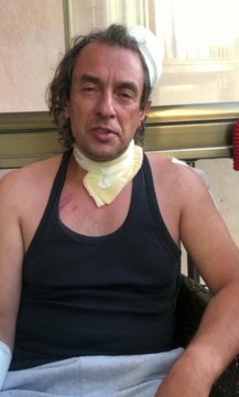 ALKOLLÜ YOLCU TAKSİ ŞOFÖRÜNÜ ISIRDI, DARBETTİ, ARACINA BİNİP KAZA YAPTI