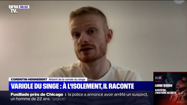 On manque d'informations à propos de la maladie : le témoignage de Corentin, atteint de la variole du singe