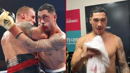 Ünlü boksör çenesi kırılmasına rağmen müsabakayı kazandı! 2 ay sıvıyla beslenecek