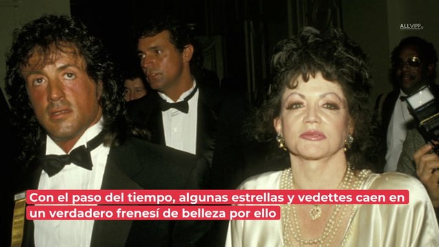 Famosos y bótox: ¿quiénes se han sometido a estos tratamientos estéticos?