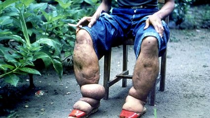 5 Curiosas Enfermedades que no Conocias