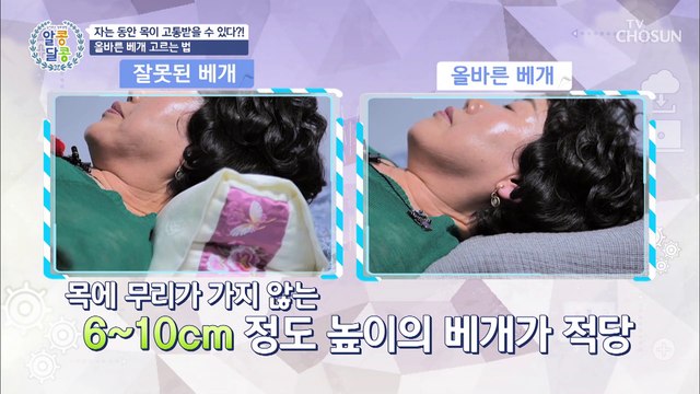 예방이 최고의 보약! 목 디스크 자가 진단법 大공개★ TV CHOSUN 20220707 방송