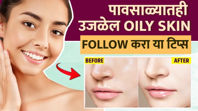 तेलकट त्वचेची काळजी कशी घ्यावी? | How To Get Rid Of Oily Skin Naturally | Oily Skin Care Tips