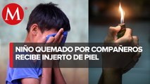 Caso de niño quemado en escuela no fue considerado como tentativa de homicidio