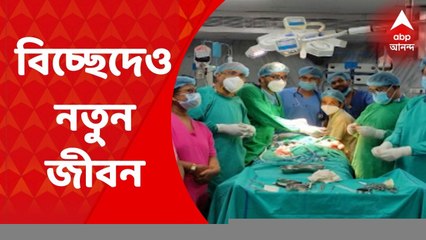 Kolkata Critical Surgery : 'জুড়ে থাকা লিভারের অংশ কেটে পৃথক যমজ শিশুকে', NRS-এ বিরল অস্ত্রোপচার