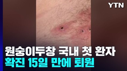 첫 확진자 15일 만에 퇴원...전용 치료제 국내 도착 / YTN
