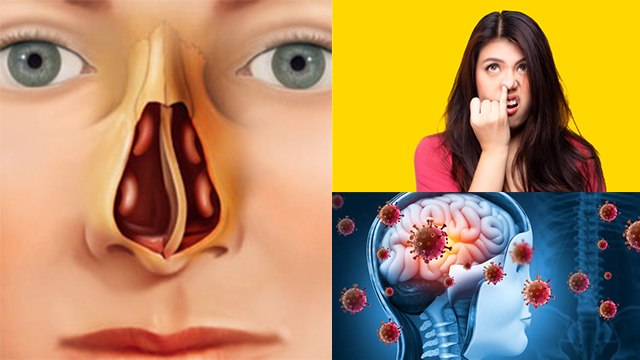 नाक मे उंगली डालने से क्या होता है | Nasal Septum Infection से लेकर Brain Damage का खतरा|*Health