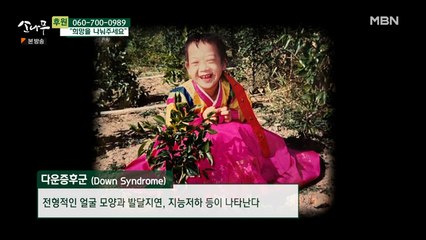 다운증후군을 앓고 있는 딸