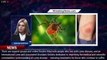 Summer Is Tick Season: How to Avoid Ticks and Prevent Lyme Disease - 1breakingnews.com