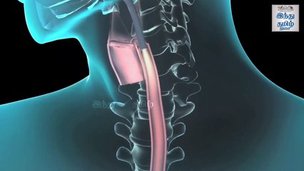 Endoscopy - இனி பயம் இல்லை