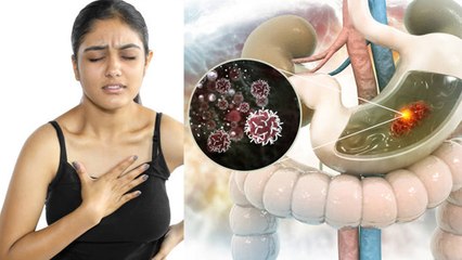 Hyperacidity में क्या होता है |हाइपरएसिडिटी में क्या करना चाहिए |Boldsky*Health