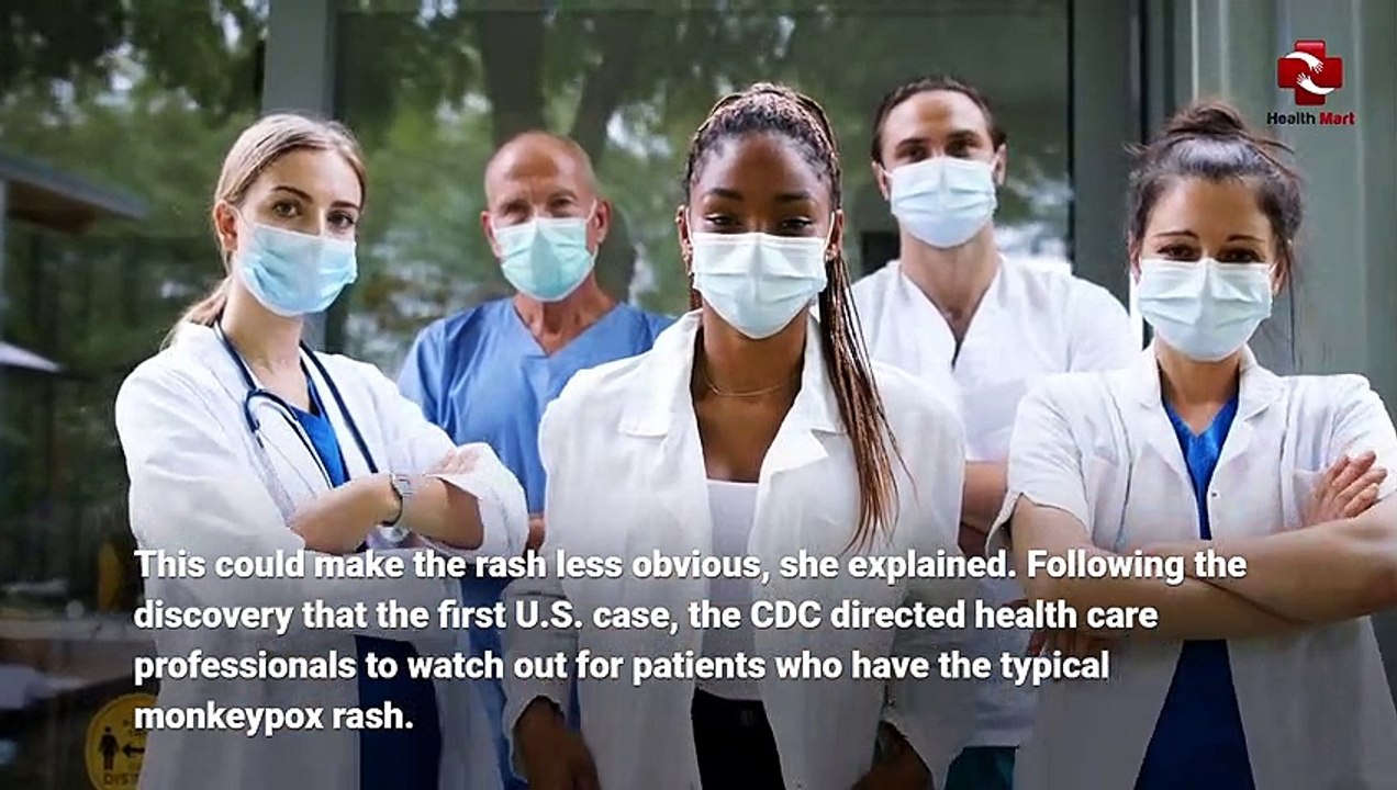 What are the initial symptoms of monkeypox