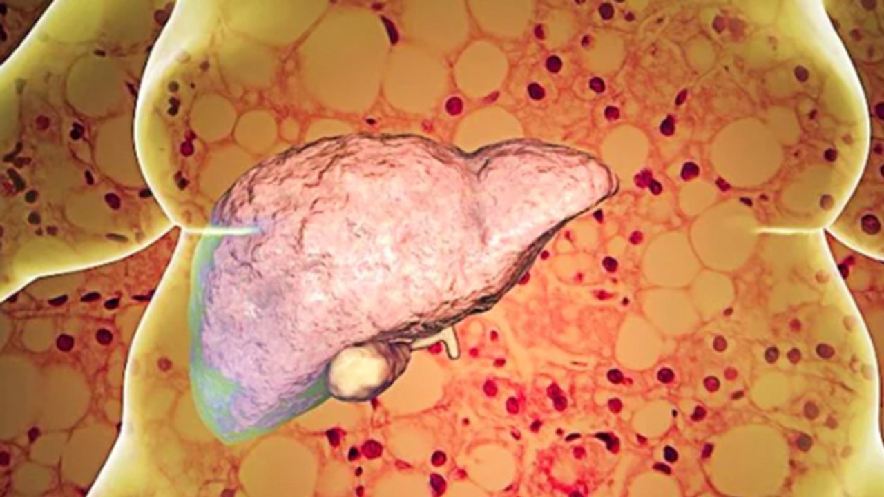 Liver me Dard Kyu Hota Hai | लिवर में दर्द क्यों होता है | Liver Pain Reason | Boldsky *Health