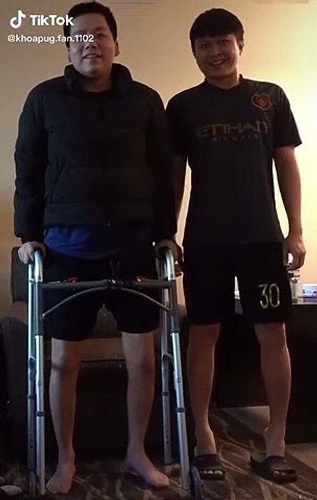 Khoa Pug cao lên 8cm sau 3 tháng kéo chân