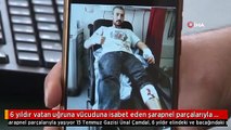 6 yıldır vatan uğruna vücuduna isabet eden şarapnel parçalarıyla yaşıyor