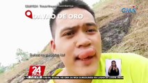 #KuyaKimAnoNa?: May venom ang bee sting o kagat ng mga bubuyog kaya namamaga ang katawan ng tao; kumonsulta sa doktor kung makakaranas ng matinding sintomas | 24 Oras