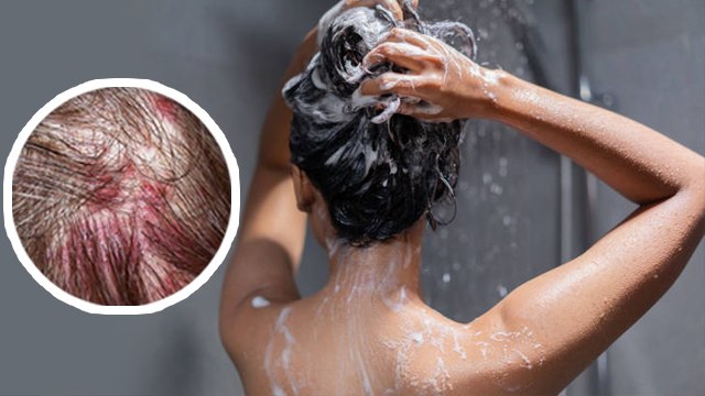 Hairs में Shampoo से पहले क्यों करें Conditioner | Reverse Hair Washing क्या है | Boldsky *Health