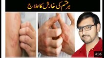 Best Homeo Pathic Medicine for itching | kharish | Dr. Syed Muhammad Danish Shah