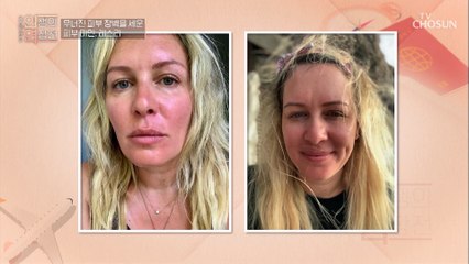건강한 꿀피부를 되찾은 그녀의 꿀TIP은?　TV CHOSUN 20220713 방송