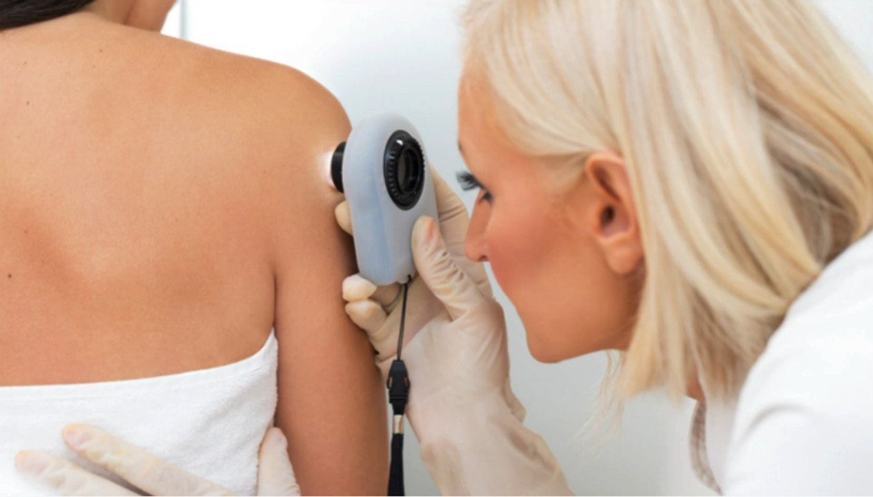 Radioaktive Paste soll weißen Hautkrebs heilen