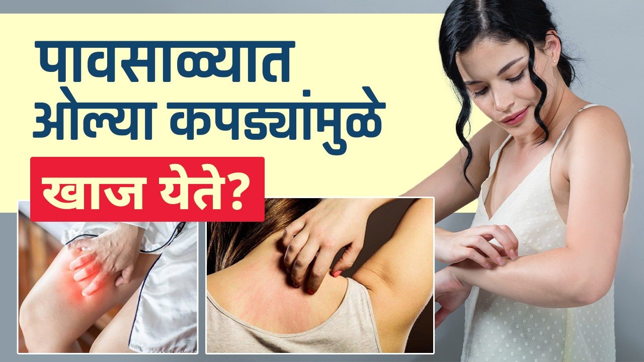 पावसाळ्यात ओल्या कपड्यांमुळे खाज येत | How To Treat Itchy Skin Rash Naturally | Itchy Skin Rashes