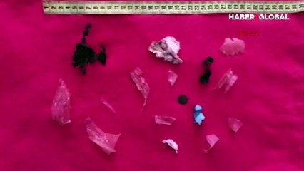 Plastik kirliliği can aldı! Bağırsakları tıkanan caretta caretta öldü