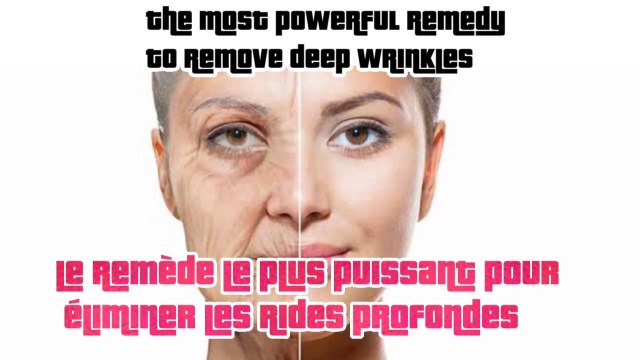 THE most powerful homemade cream to remove deep wrinkles | Skin care