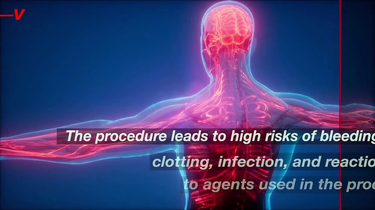 People With Long COVID Are Spending Thousands Traveling Overseas for Expensive ‘Bloodwashing’ Treatments