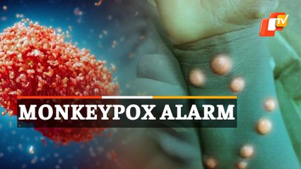 Monkeypox Alarm | Health Ministry Issues Guidelines
