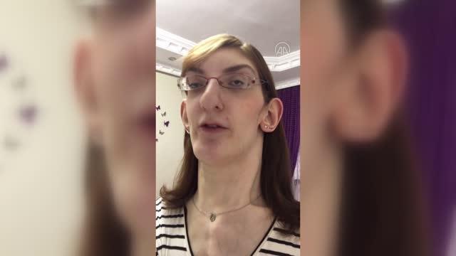 Dünyanın en uzun boylu kadını Rumeysa Gelgi ilk uçak seyahatini THY ile yapacak