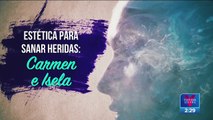 Fundación Carmen Sánchez apoya a mujeres atacadas con ácido