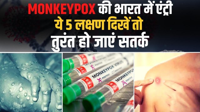 Monkeypox Virus: ये लक्षण दिखें तो तुरंत हो जाएं सतर्क, नहीं तो हो सकते हैं मंकीपॉक्स का शिकार