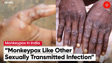 35-Year-Old From Kerala Is India’s First Monkeypox Case; Centre Sends Team