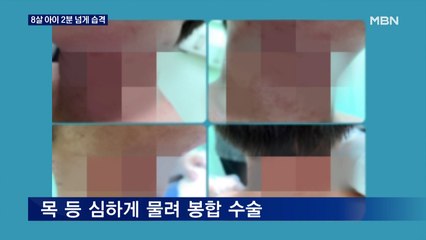 쓰러진 8살 아이 2분간 목·팔·다리 습격…진돗개 잡종 안락사 결정