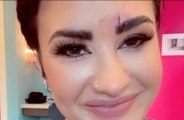 Demi Lovato suffers bloody face injury