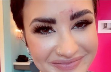 Demi Lovato suffers bloody face injury