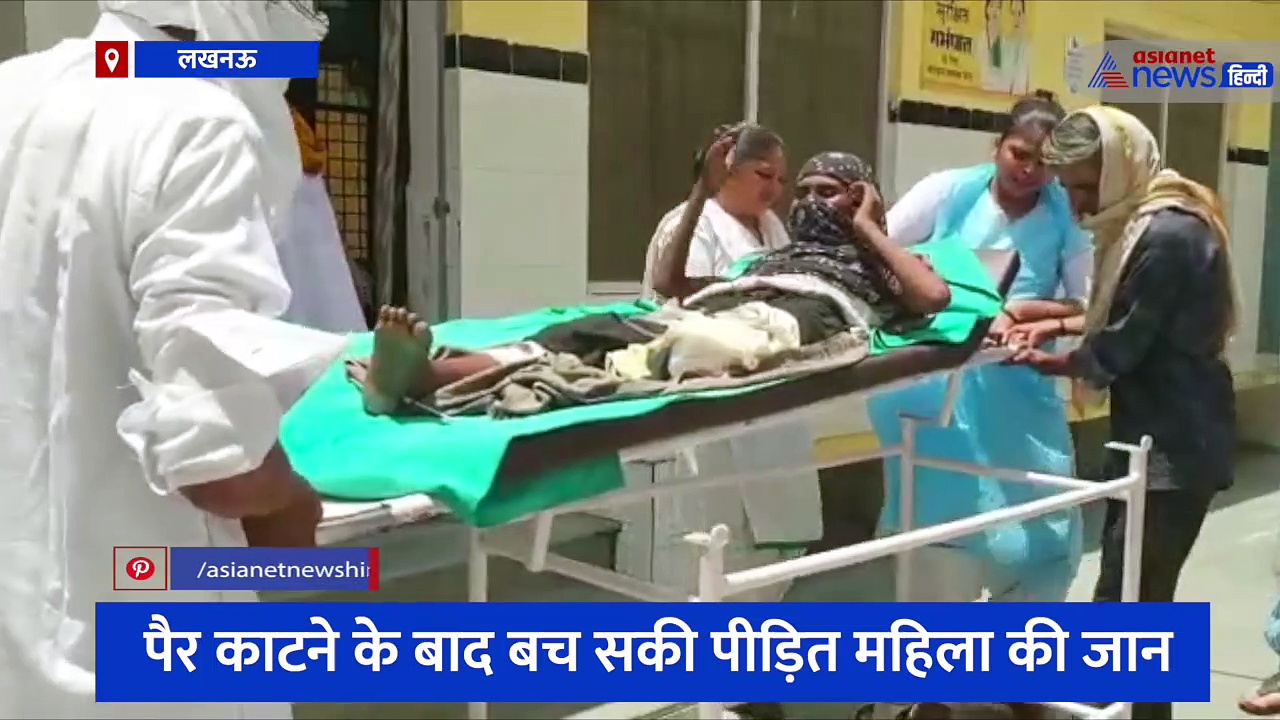 दुष्कर्म के बाद बलात्कारियों ने तोड़ी दलित महिला की टांग, पैर काटकर डॉक्टरों ने बचाई जान