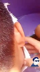 Joven hizo máscara de yeso como tarea y se le pegó en el rostro