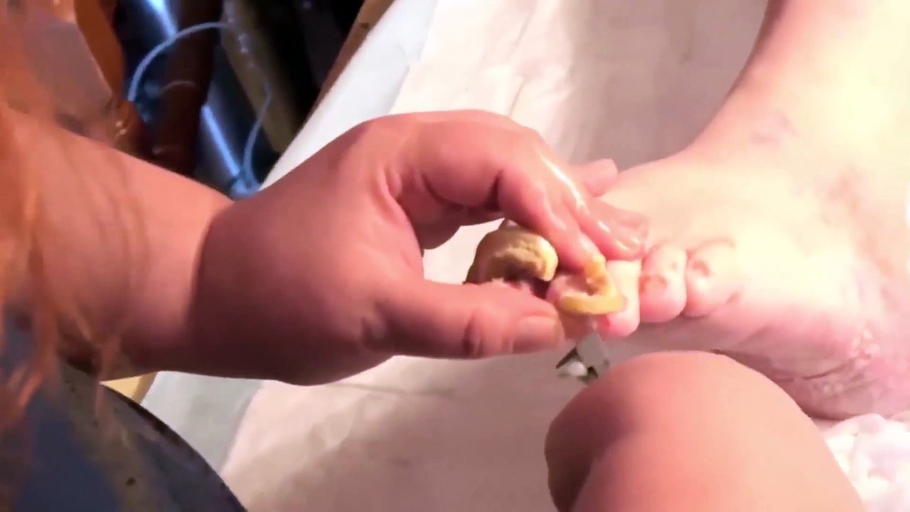 HOW TO CUT THICK TOENAILS - Toenail Cleaning Satisfying #3